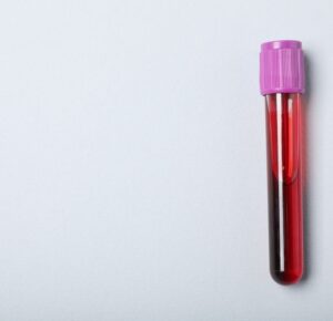 Jakie badania wykonać przy obniżonym poziomie leukocytów?